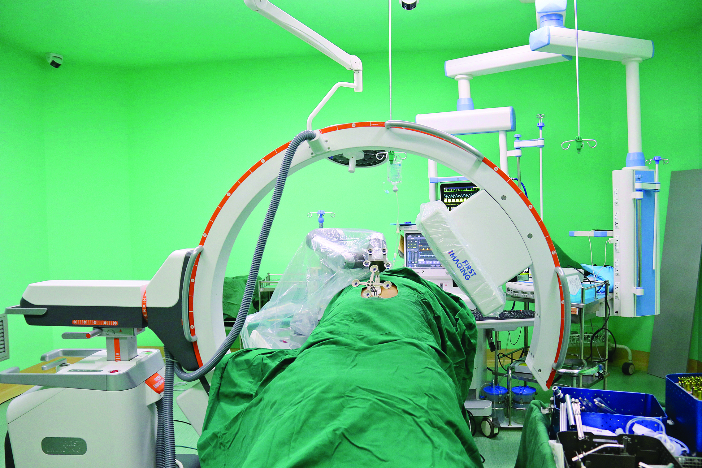     骨科机器人辅助手术。